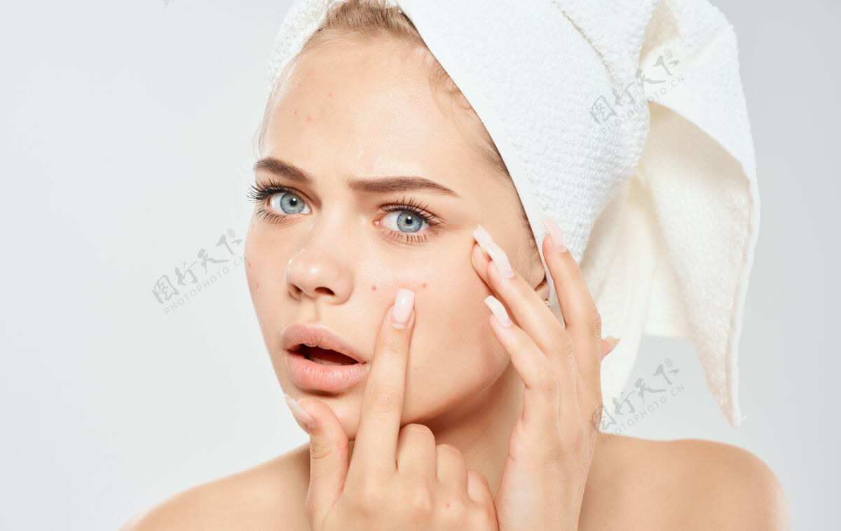 护理一个女人头上带着毛巾挤出脸上的青春痘问题皮肤美容皮肤科女士药物问题