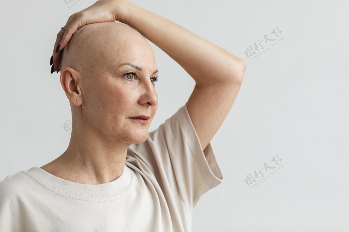 复制空间有复制空间的皮肤癌女人女人健康战斗