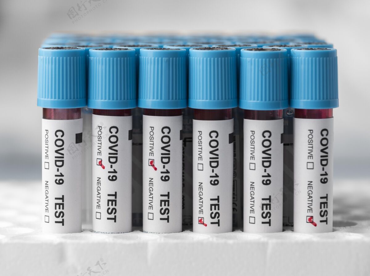 检疫实验室里做柯维德测试的血样血液测试症状预防