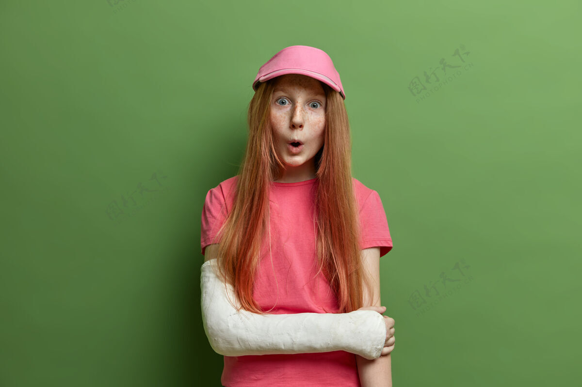 治疗孩子们 脸上表情概念满脸雀斑的女孩惊讶地看着 手臂骨折了 戴着玫瑰色的帽子和t恤 孤立在绿色的墙上 从自行车上摔了下来狐狸帽子印象